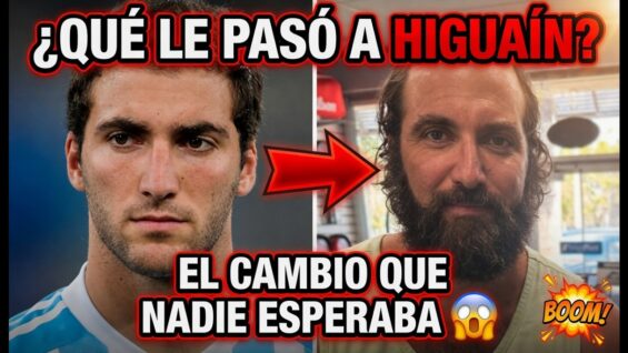 ¿Qué le pasó a Higuaín? El brutal cambio que nadie